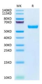 SDS-PAGE (IGF2R-344H).jpg